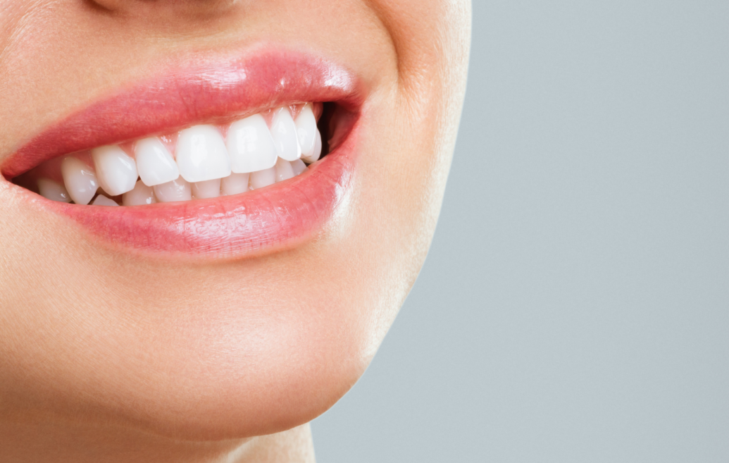 blog - Mumbles Dental